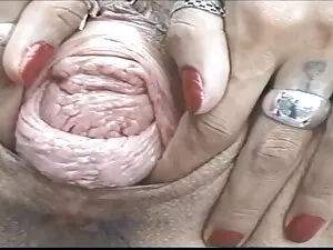 Negritoska اشتها آور ...